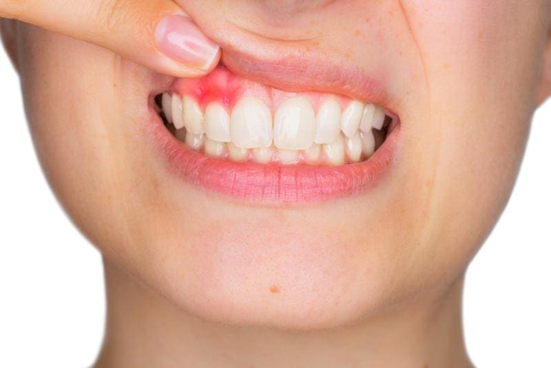 Periodontologia