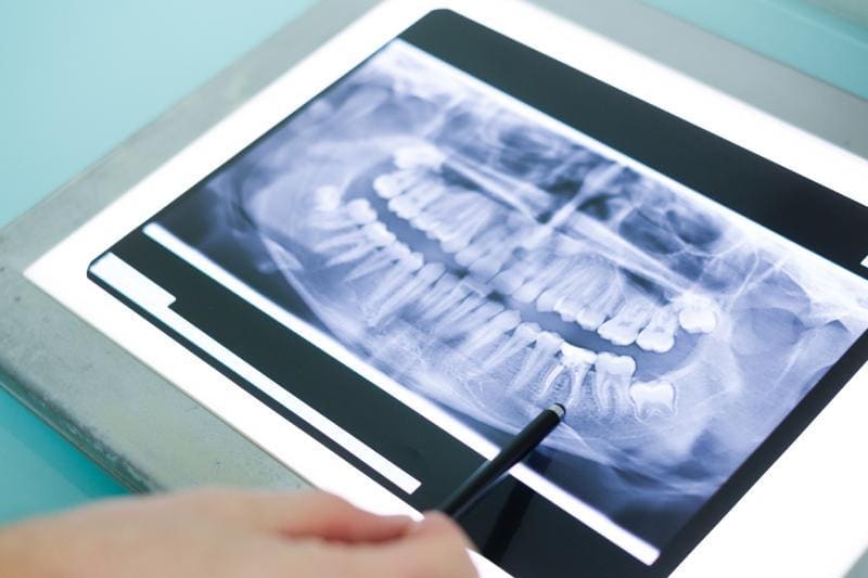radiologia stomatologiczna